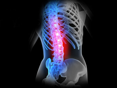 Lumbar Spondylosis Treatment