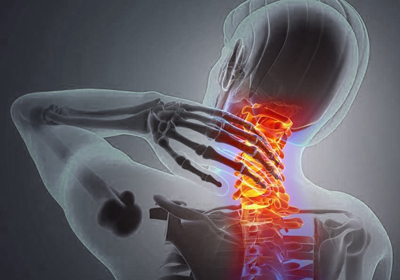 Neck Pain Treatment
