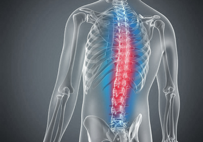 Thoracic Mid-Back Pain