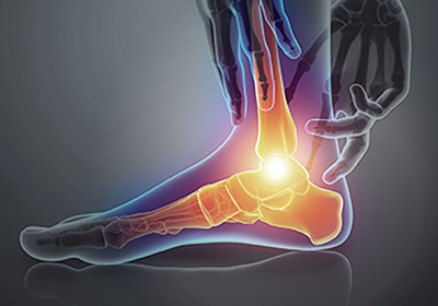 Plantar Fasciitis Heel Relief
