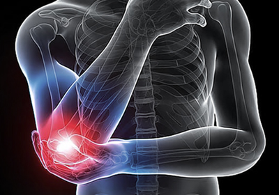 Tennis Elbow Rehabilitation